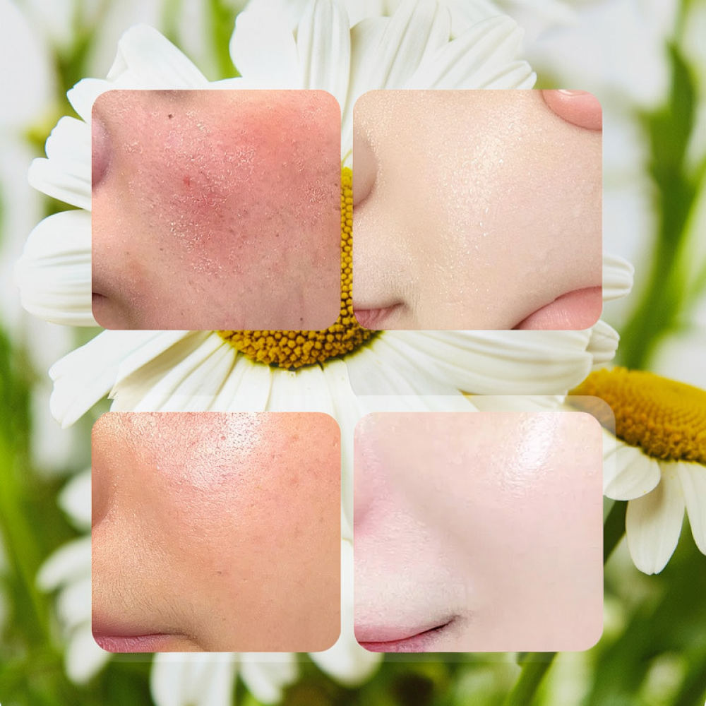 Face Mask Skincare - สำหรับมาสก์หน้าชนิดแผ่น Fykly Rose VC Chamomile B5