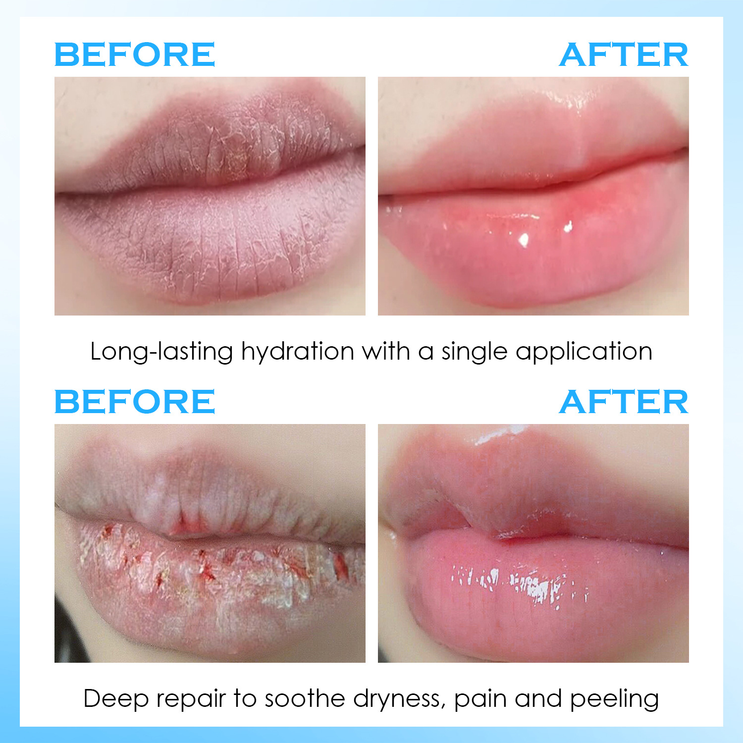 เซรั่มบำรุงริมฝีปาก บาล์มให้คว - Lip Balm บทวิจารณ์และราคา