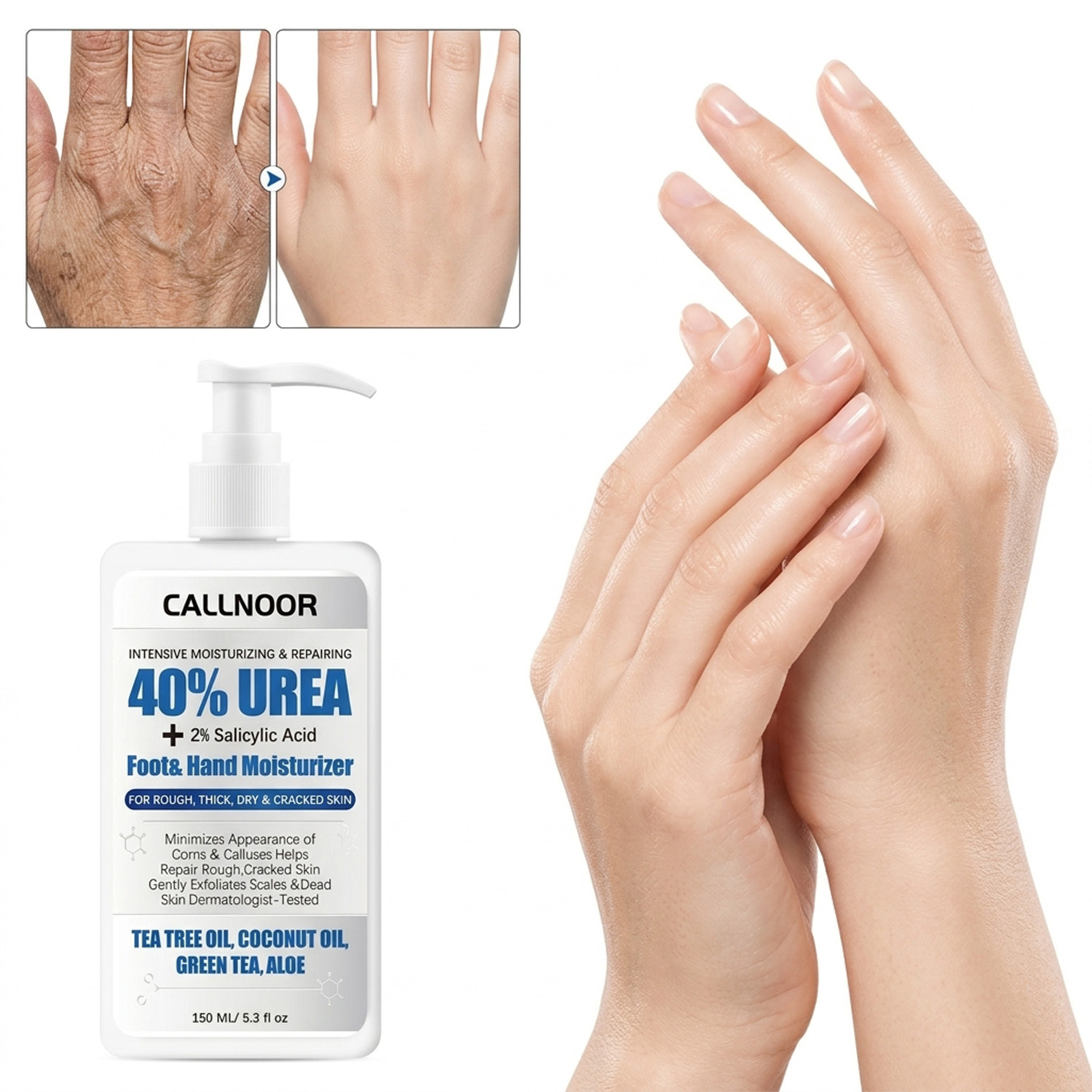 ครีมบำรุงมือและเท้า 0% ยูเรีย  - Urea Foot Cream บทวิจารณ์และราคา