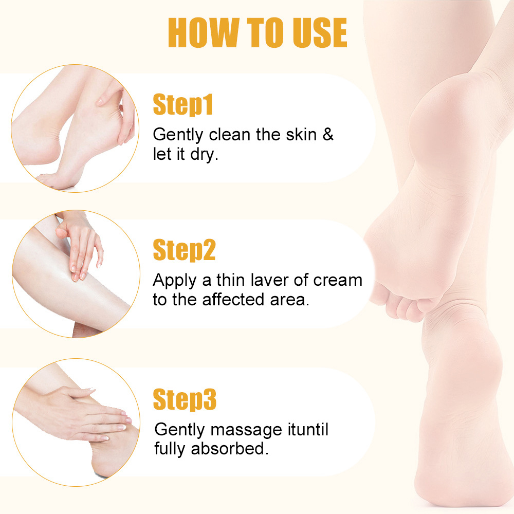ยูเรียครีม 60% Salicylic Acid  - Urea Foot Cream บทวิจารณ์และราคา